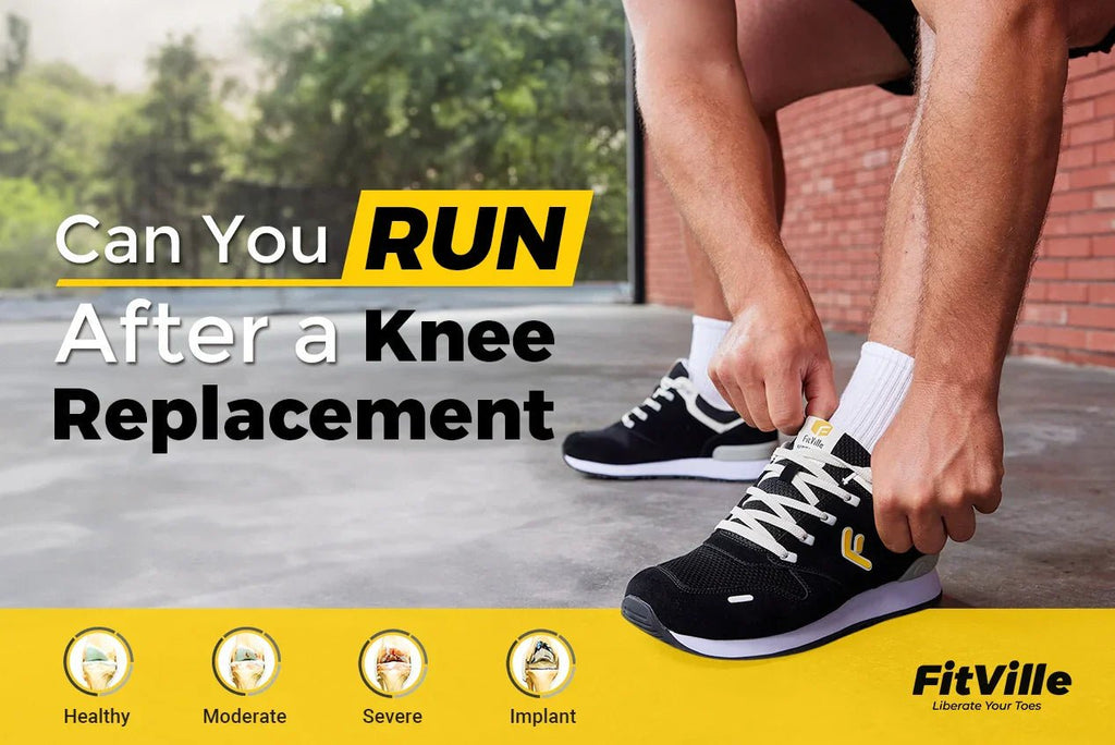 Can You Run After a Knee Replacement? - FitVilleUK