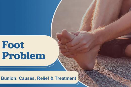 Bunion: Causes, Relief & Treatment