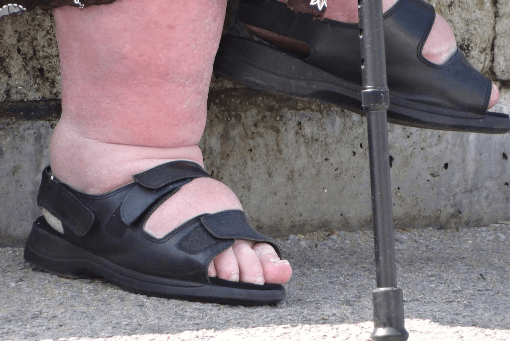 Are 6E shoes The Solution to Your Swelling Feet? - FitVilleUK