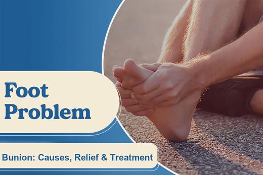 Bunion: Causes, Relief & Treatment - FitVilleUK