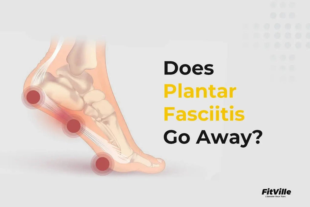 Does Plantar Fasciitis Go Away? - FitVilleUK