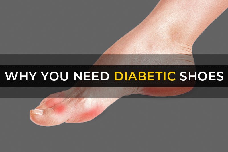 Why you need diabetic shoes - FitVilleUK